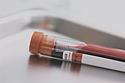 Blood Test Vial